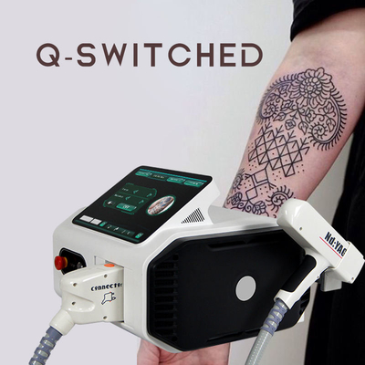 Rimozione del tatuaggio del laser del ND Yag di meglio