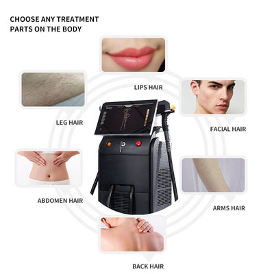 755 808 1064 laser a diodi di depilazione del laser a diodi